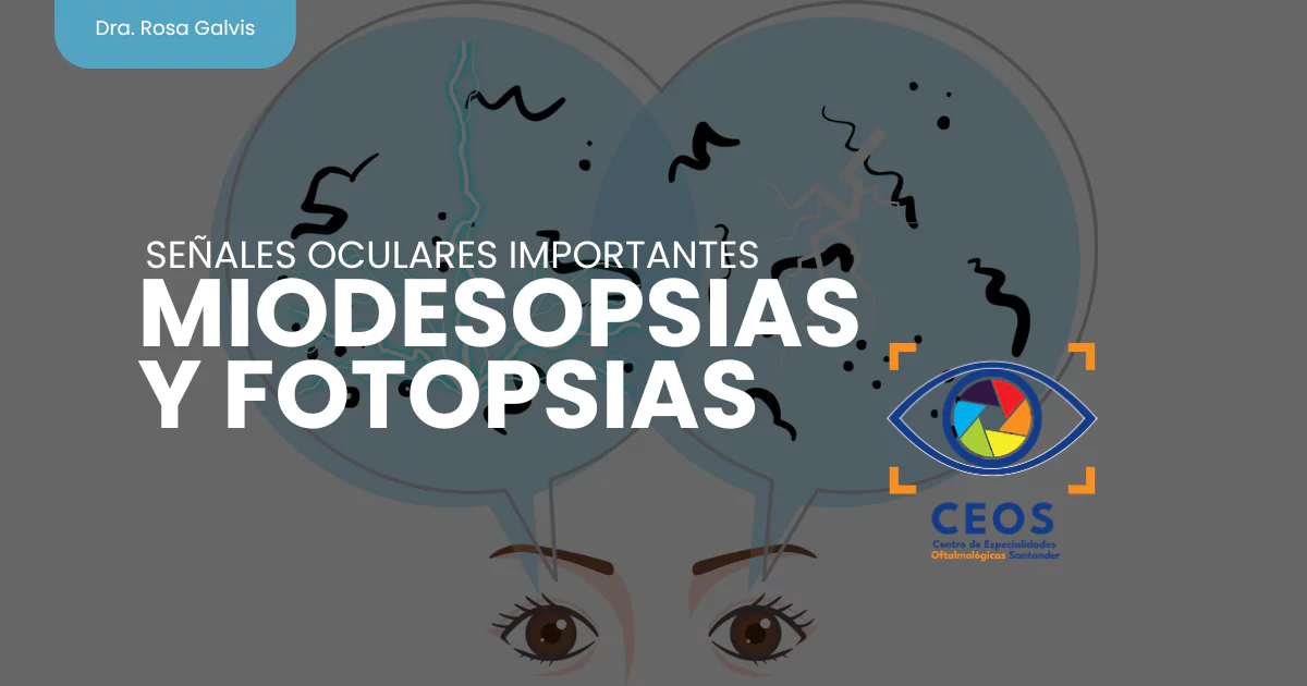 Miodesopsias y Fotopsias Señales Oculares Importantes | Oftalmólogos en ...