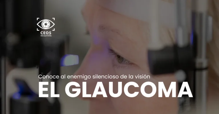 Glaucoma - el enemigo silencioso de la visión